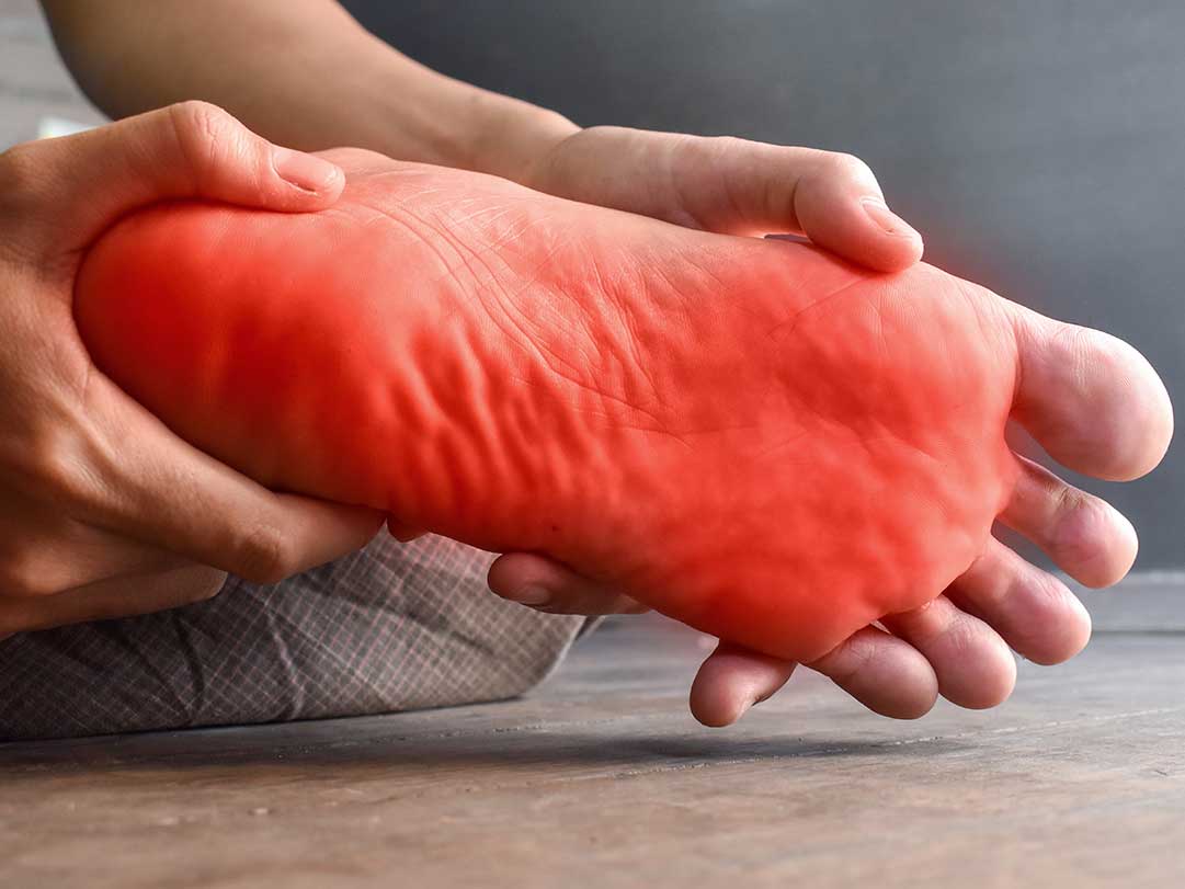 neuropathy of the foot neuropathy of the foot
